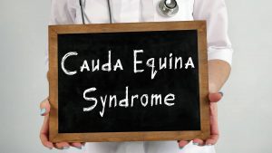 Cauda-Equina-Syndrom - Was ist das? Eine Definition