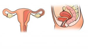 definition von uterus 300x169 - Was genau ist ein Uterus? Eine Definition