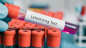 luteinisierendes hormon 300x169 - Luteinisierendes Hormon - Was ist das? Eine Definition