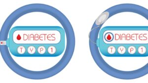 Typ-1-Diabetes: Wichtiger Durchbruch bei Therapien ohne Insulininjektion