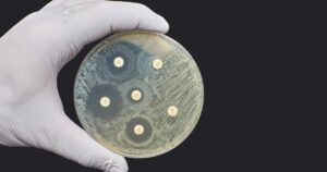 2 antibiogramme 300x158 - Tödlicher Pilz breitet sich in den USA rasant aus