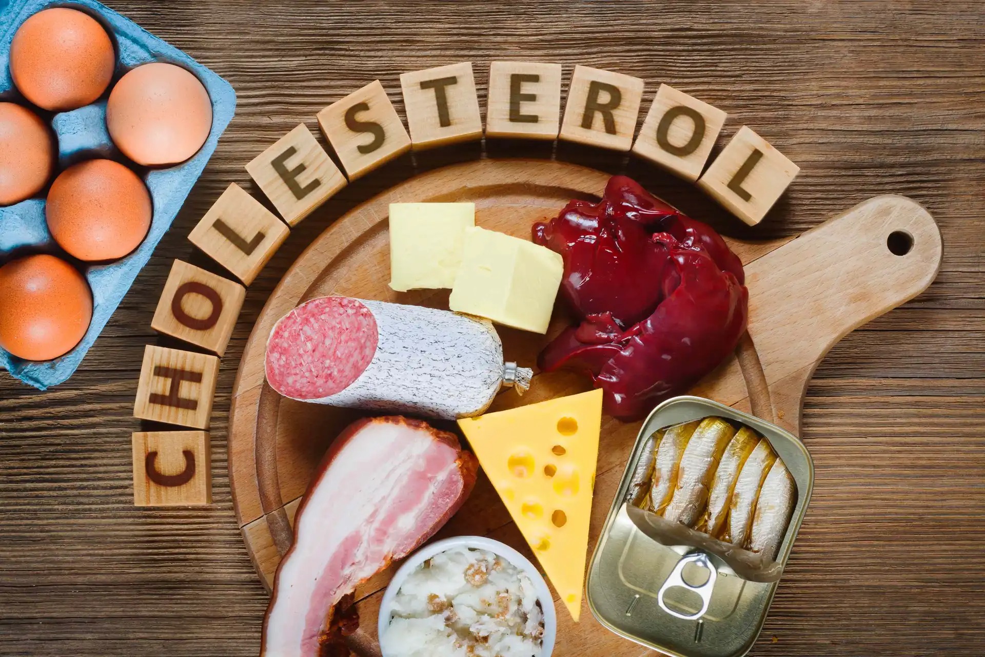 cholesterol - Welche Lebensmittel sind schlecht für den Cholesterinspiegel?