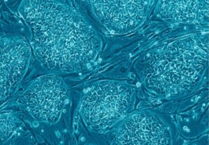 cellule souche embryonnaire euge 300x209 - Stammzelle: Was ist das? Eine Definition