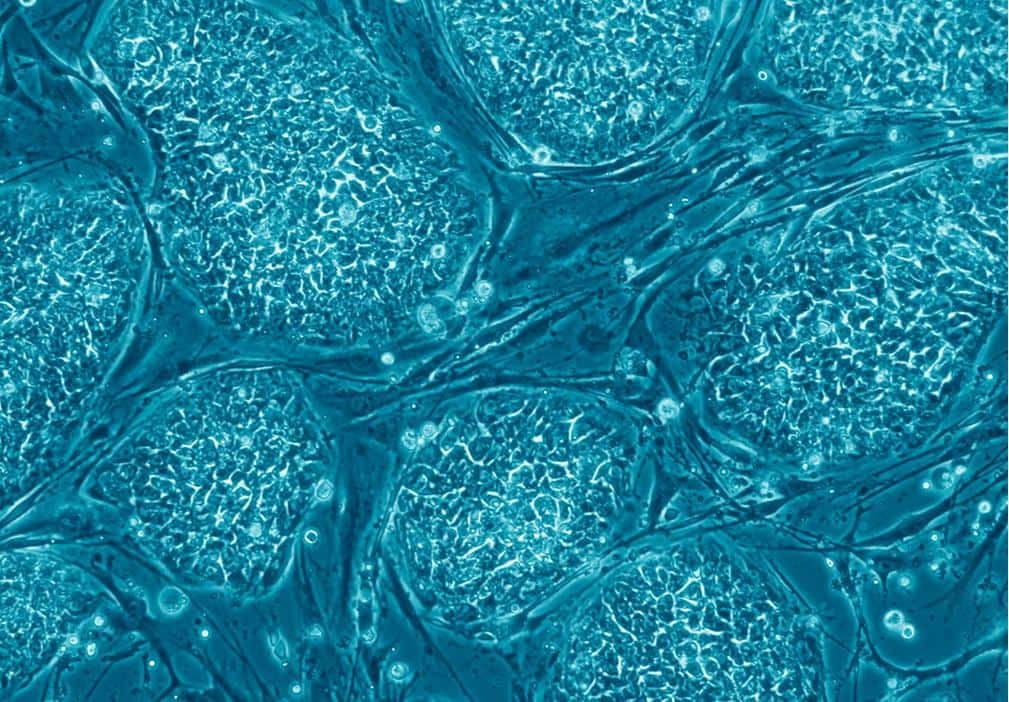 cellule souche embryonnaire euge - Stammzelle: Was ist das? Eine Definition