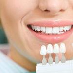 Les 6 meilleurs blanchiments dentaires 2024 - blanchiment dentaire test & comparatif