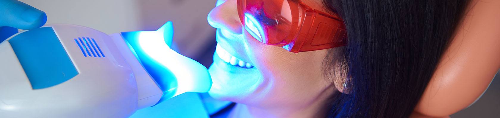 Les 5 meilleurs blanchiments dentaires 2024 – blanchiment dentaire test & comparatif